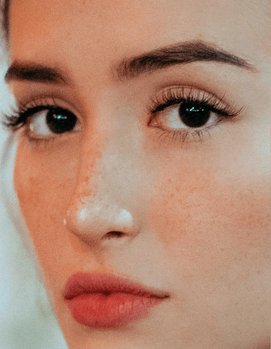 Lower Eyelid Surgery (Blepharoplasty)