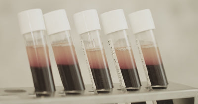 Video Hair Restoration