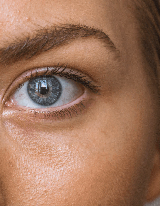 Upper Eyelid Surgery (Blepharoplasty)